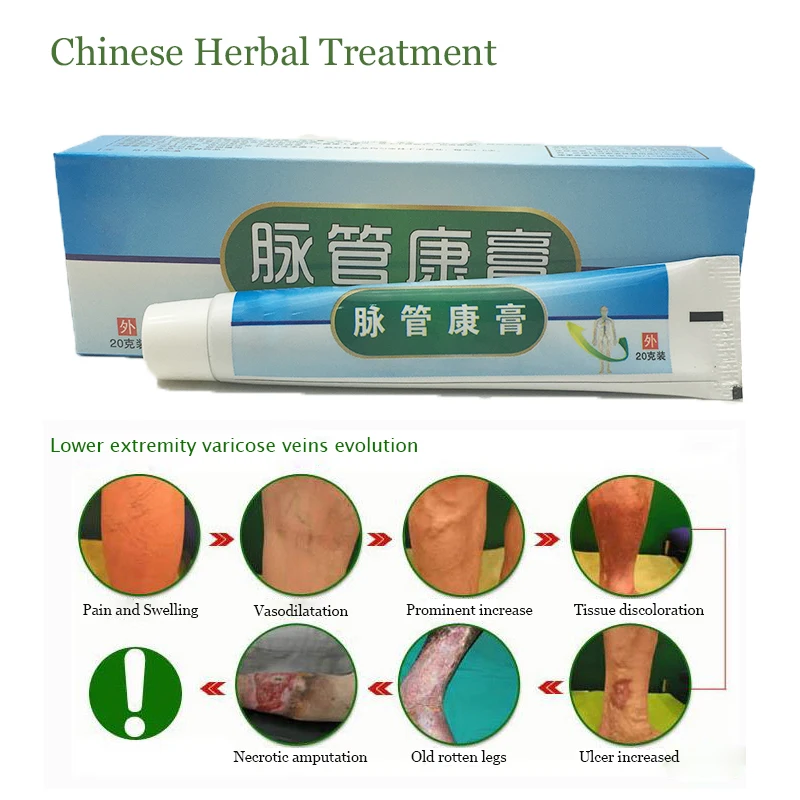 

Varicose Veins ointment vasculitis treatment Phlebitis Angiitis inflammation blood vessel Rotten legs Varicose Veins Cream