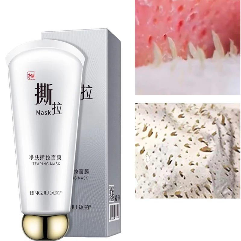 Средство для удаления черных точек в носу черная маска лица Лечение Акне поровая