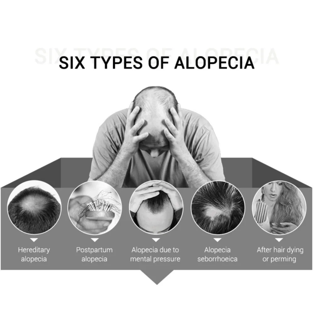 Эссенция для быстрого и мощного роста волос 20 мл продукты выпадения эфирное