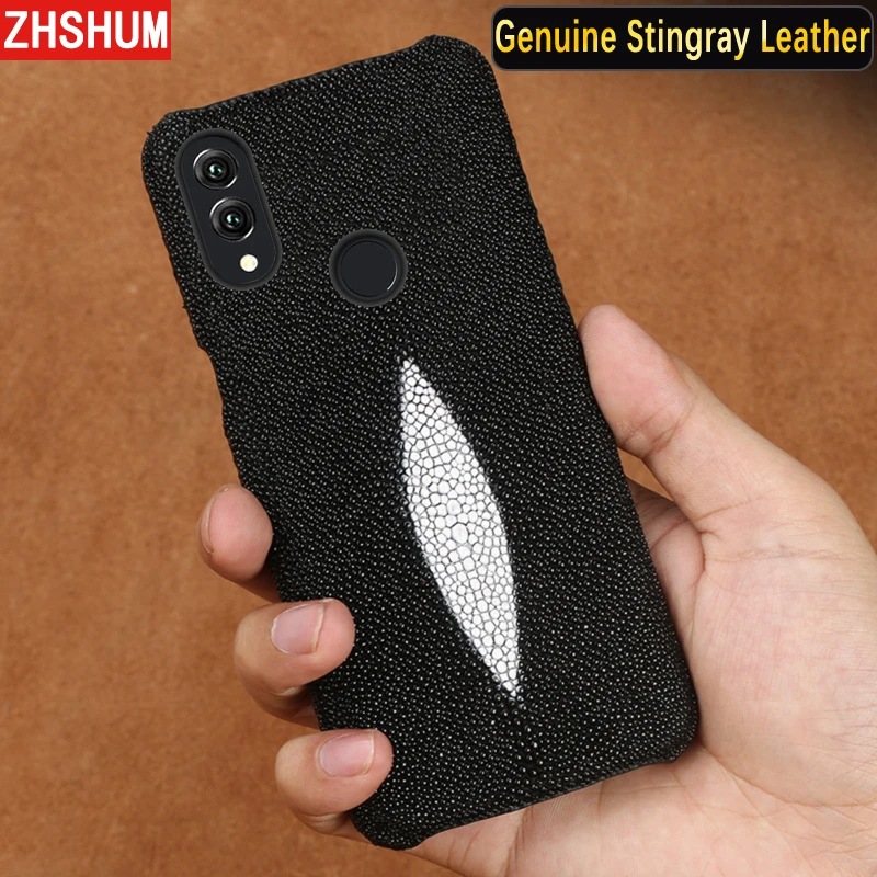 Genuine Stingray Skin Case For Huawei P20 Lite Luxury Leather Handmade Customize Full Back Cover for Honor Note 10 Note10 |