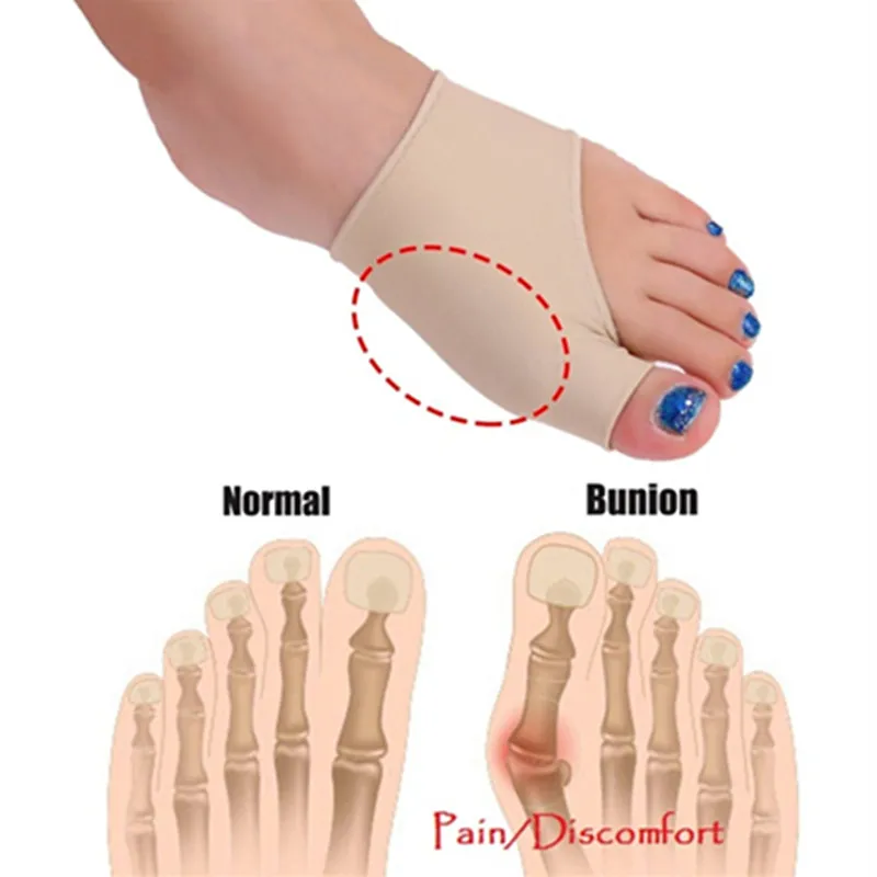 Педикюрная дышащая ткань Hallux Vagus Pro Guard Day Bunion Protector боковая силиконовая подкладка