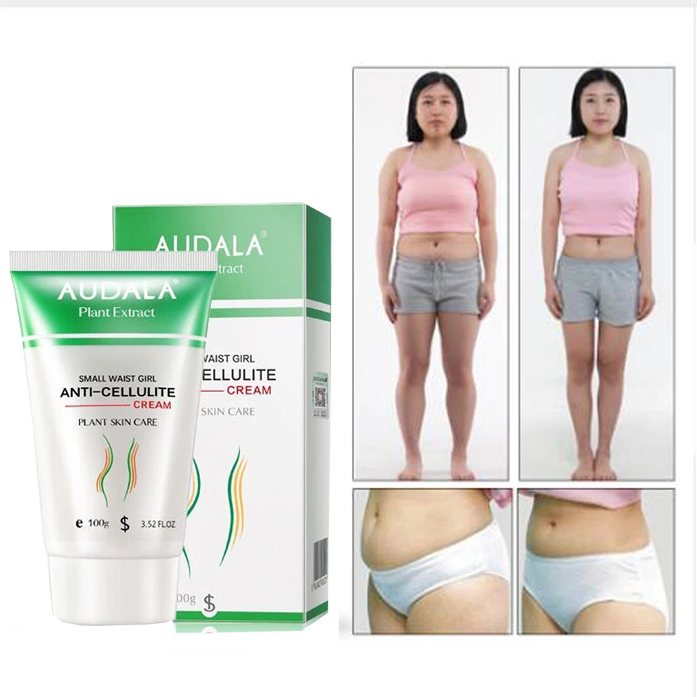 Крем антицеллюлитный для похудения 100 г| |