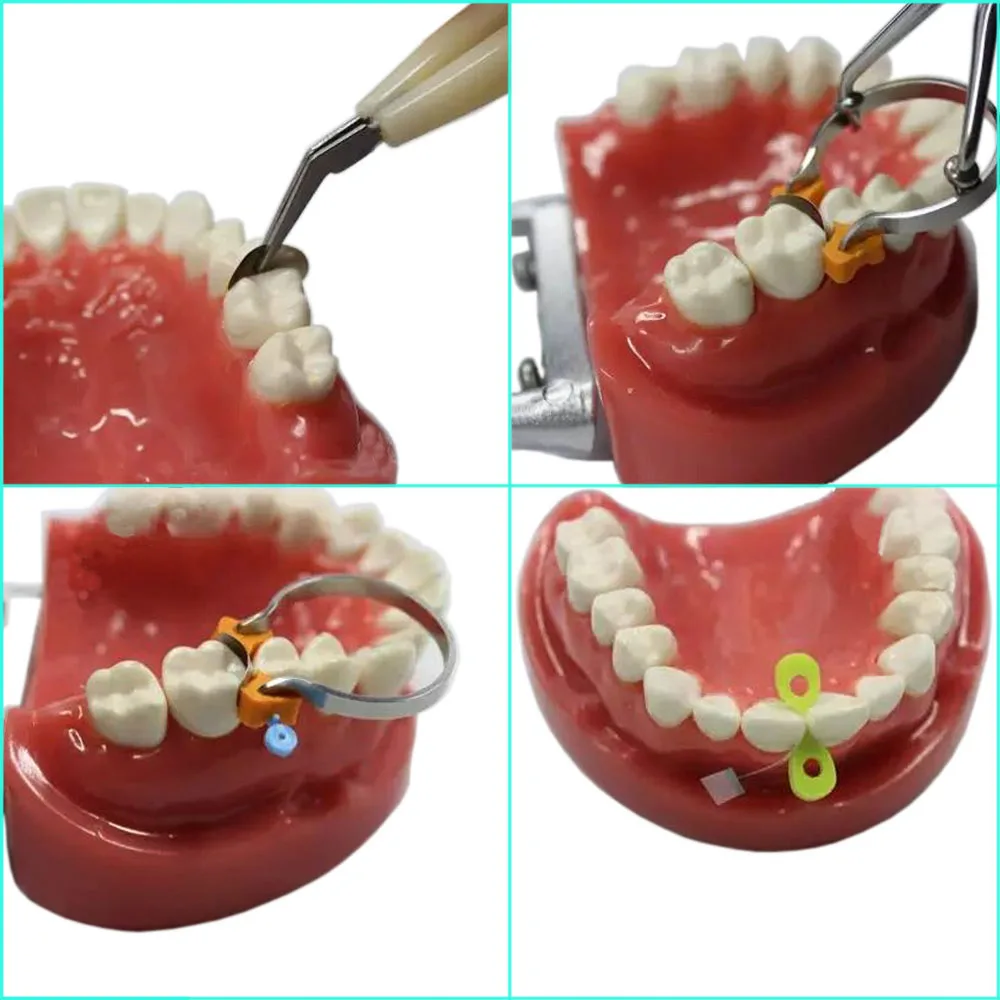 1 набор стоматологических секционных контурных матриц резиновых матричных лент