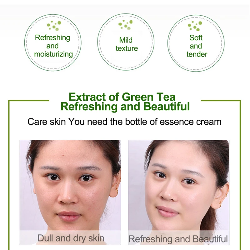 ROREC зеленый чай акне крем против Гиалуроновая кислота Отбеливающее средство для