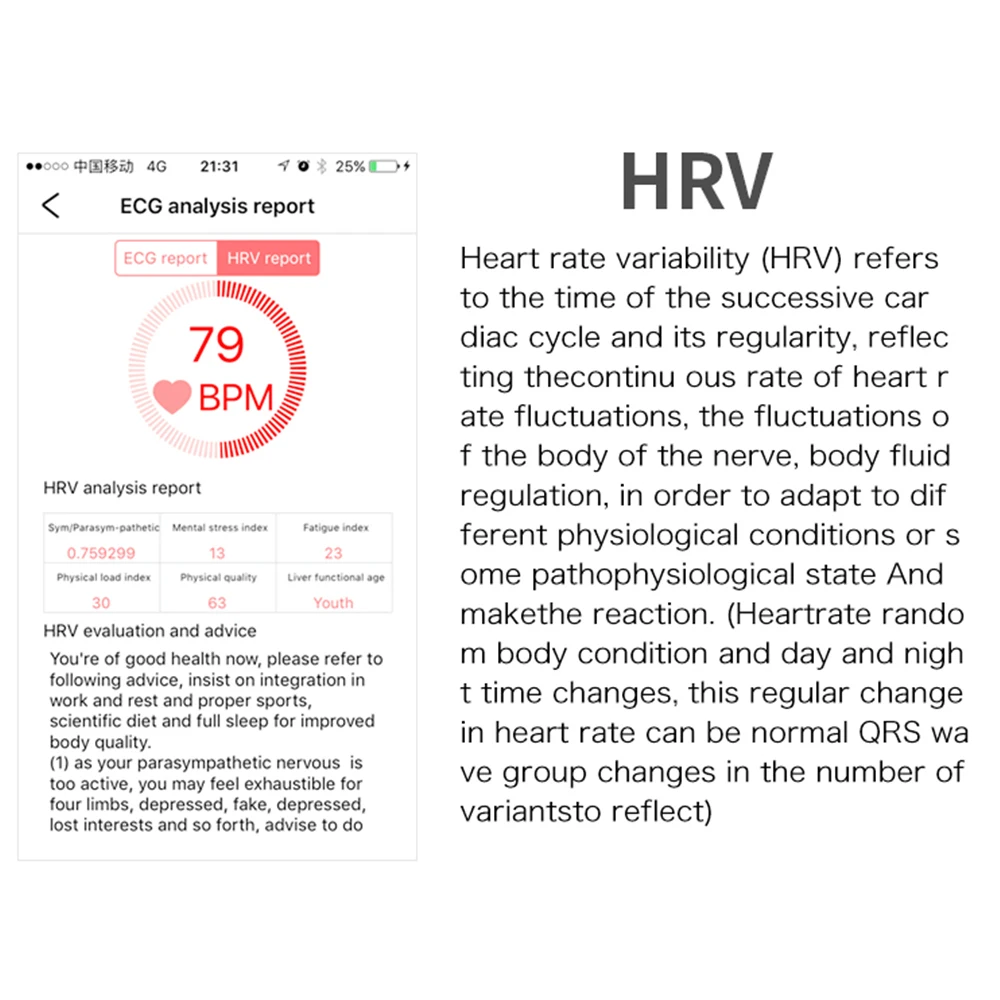 ZUCOOR Smart Bracelet ECG PPG Heart Rate Monitor RB77 Blood Pressure Band Pedometer Electronics Fitness Wristband For Women Men |