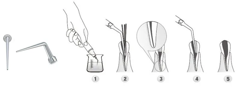 1 набор стоматологических наконечников Endo Kit EEKS fit EMS дятел SYBRONENDO с Endo Tip Endodontic instrument