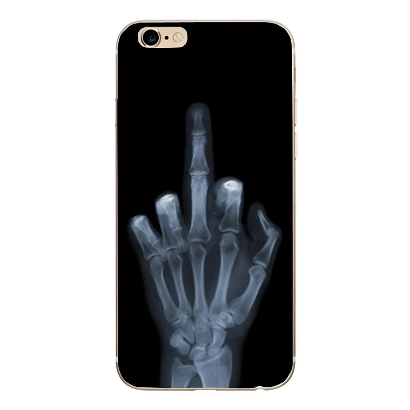 Роскошный чехол для телефона 8 с узором iphone Plus iPhone8 7 аксессуары животными X XS 6 6S 5 S