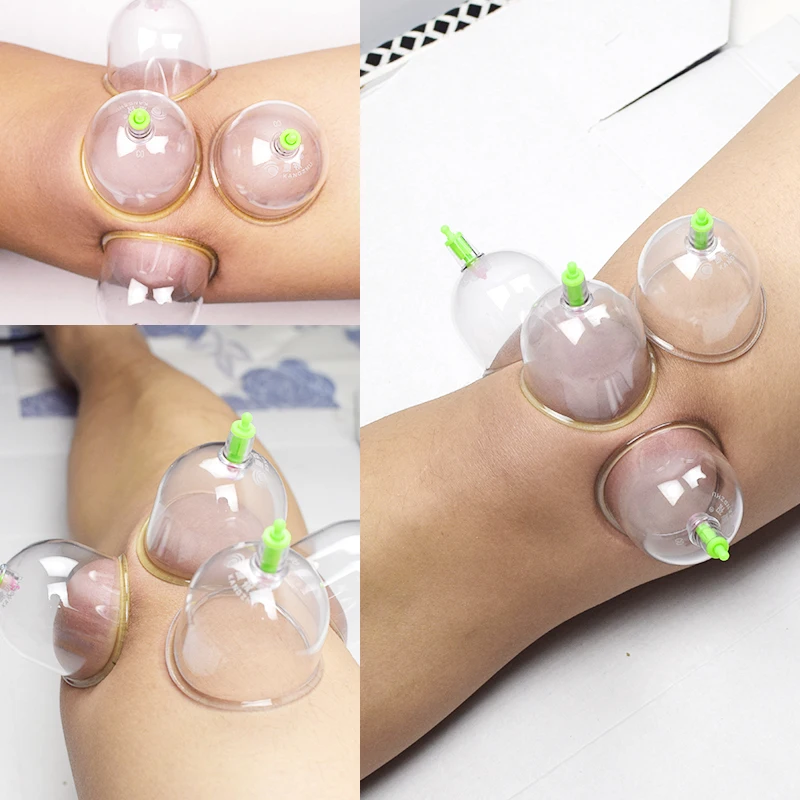 Совместные банки вакуумное устройство для купирования большой плечевого