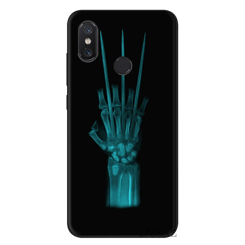 Desxz силиконовый чехол для мобильного телефона Xiaomi Redmi GO 7 S2 4A 4X5 5A Plus 6 6A Pro Чехол Росомаха X-ray рука кости сумка оболочка