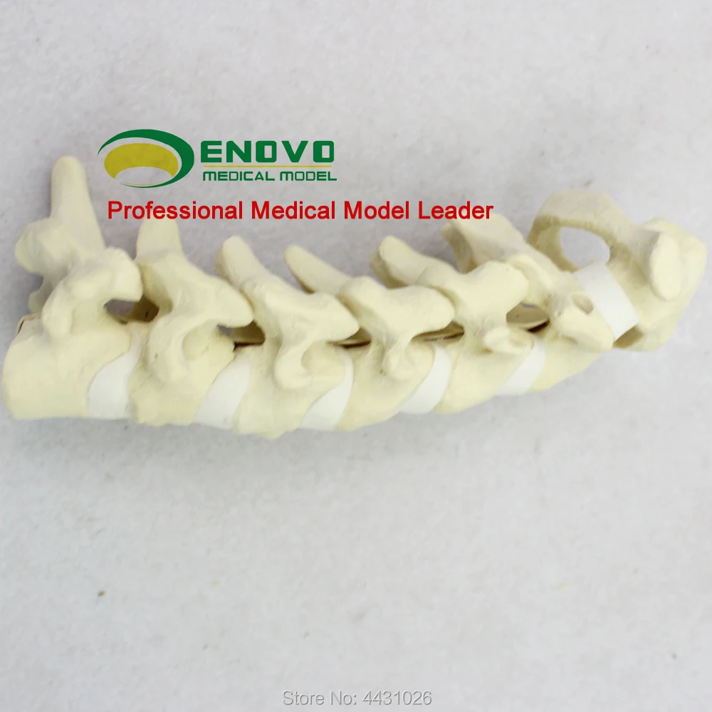 

ENOVO Bone teaching human cervical spine model medical orthopedic surgery simulation