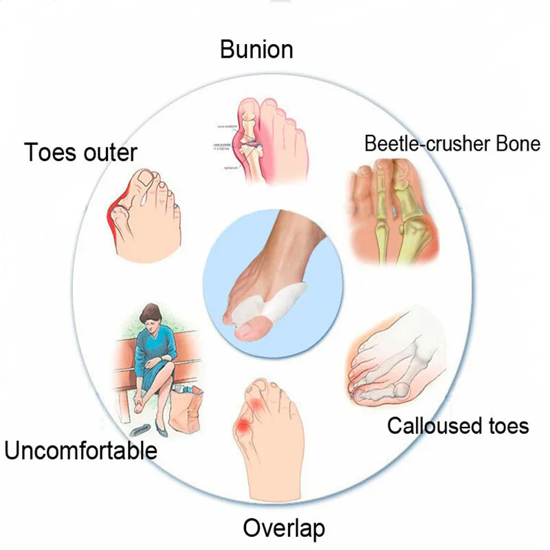 Детали 2 силиконовые разделители для пальцев ног ортопедическая коррекция
