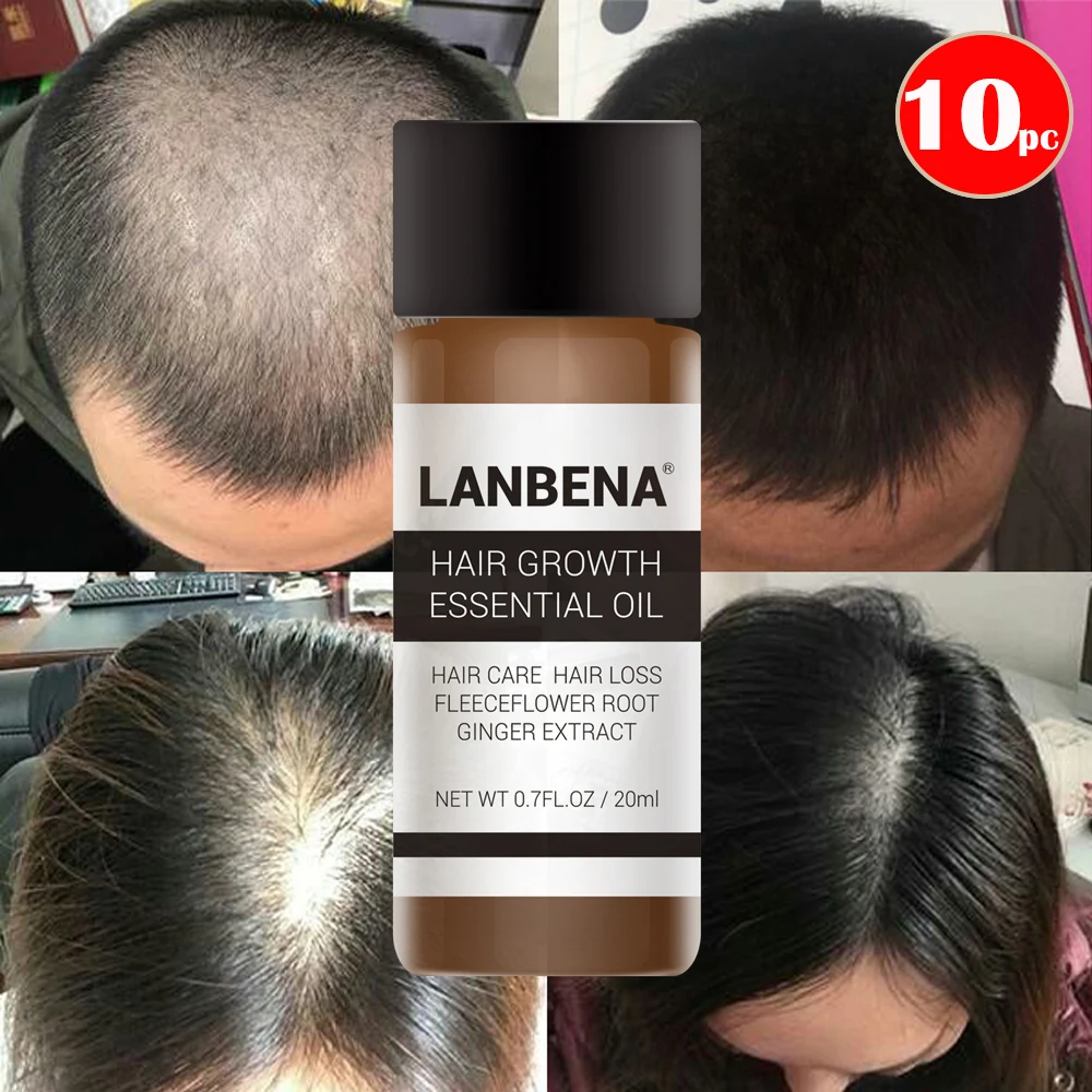 10 шт. эфирное масло для выпадения волос LANBENA мужчин и женщин набор ремонта