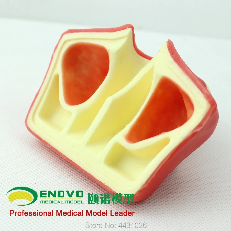 

ENOVO Dental implant training on maxillary sinus augmentation of maxillary sinus