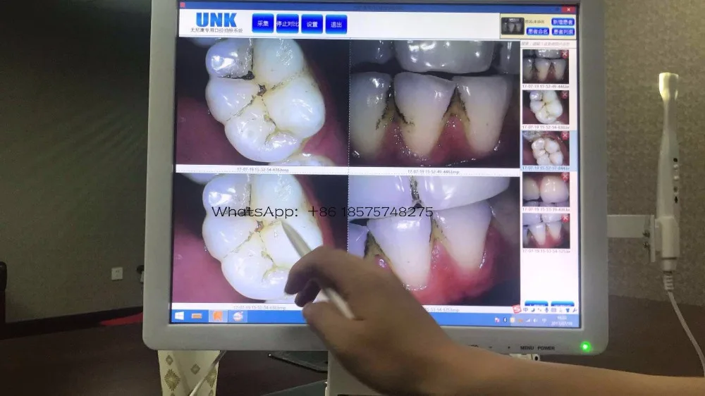 Стоматологическая Камера с монитором плотно прилегающие к уху супер чистый