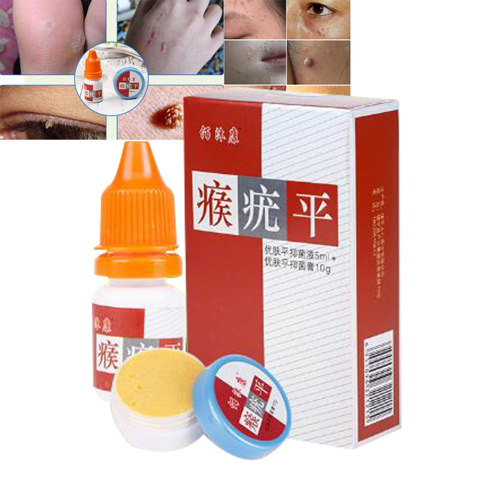 Крем для лечения бородавок китайский традиционный пластырь удаления мозолей на