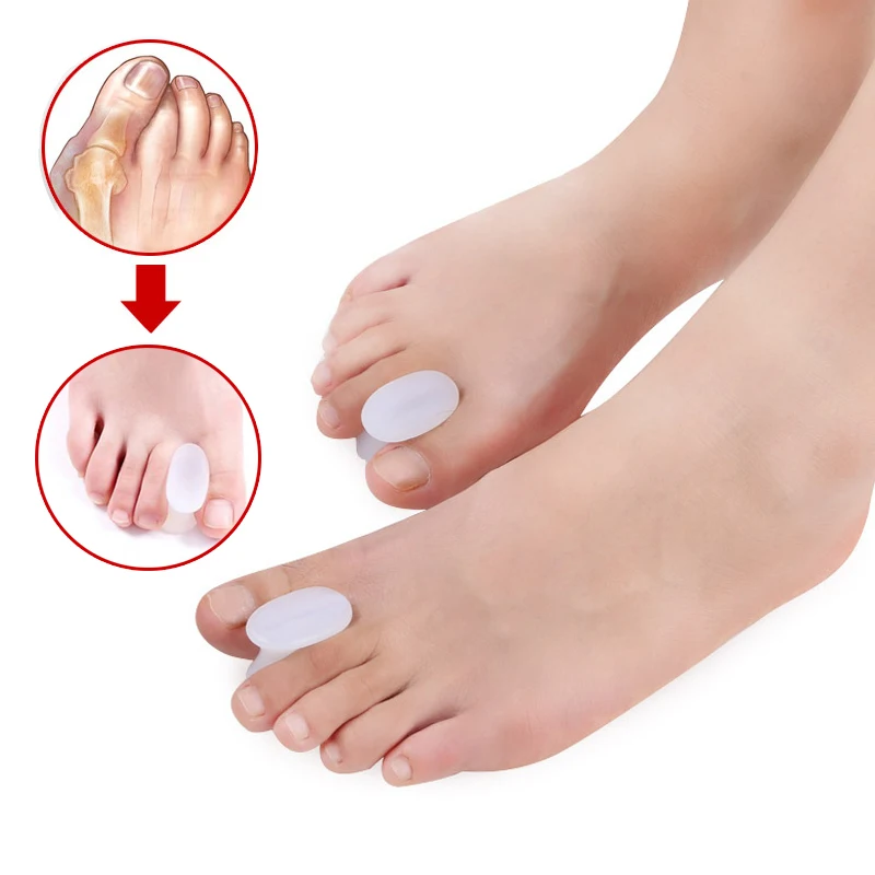 2 шт. = 1 пара силиконовый разделитель для пальцев ног|relief sciatica|pain relief patchrelief scope |