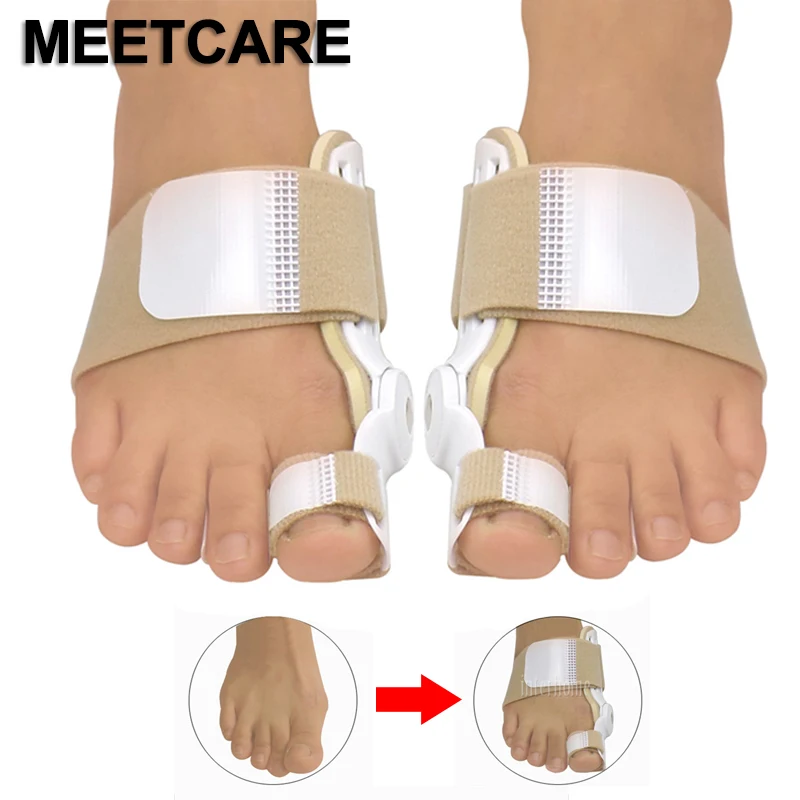 1 пара оригинальный Bunion Splint корректор большого пальца ноги облегчение боли