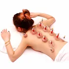 Вакуумные китайские акупунктурные терапевтические вакуумные медицинские банки для терапии тела терапевтические чашки массаж