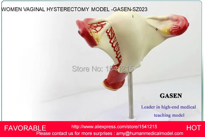 Модель матки модель генитальной анатомии учебная медицинская планирования
