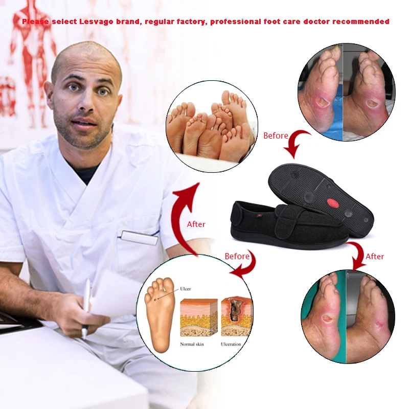 Модные мужские зимние диабетической хлопок Повседневная обувь с коротким плюшем