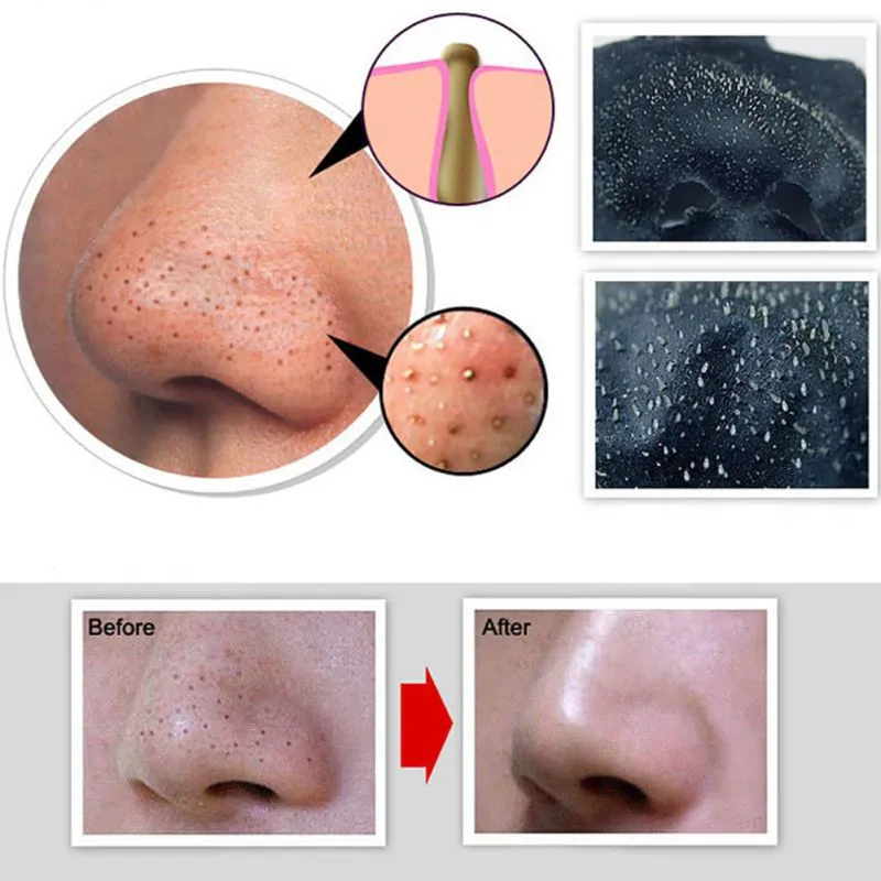 

2017 new arrival deep cleanse blackheads Volcanic mud mask 6g/pcs, Blackhead-cleaning Mask balance the exudation of skin grease