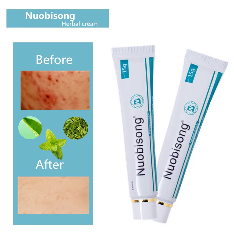 1pcs herbal care product relieve Psoriasis Dermatitis Eczema Pruritus effect Have Retail Box Hot Selling NUOBISONG | Красота и