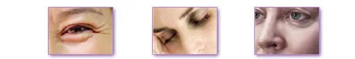 Эфирное масло для глаз ARTISCARE beauty для темных кругов под глазами уход за лицом против морщин уход за кожей масло против старения массажное масло для глаз
