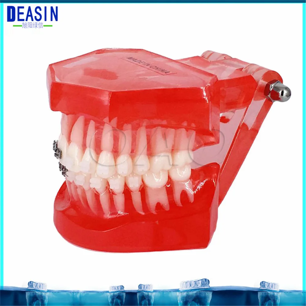 

Teeth Model with Metal Irregular Tooth Ortho Metal Dentist Patient Student Study Teaching Teeth Model Caries Tooth Care