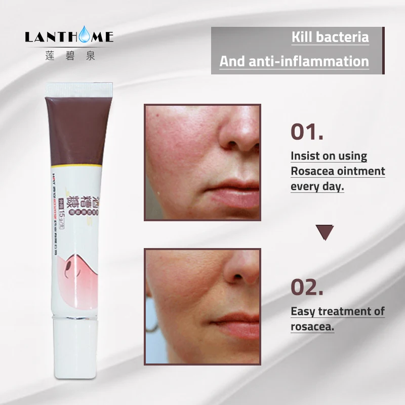 2 шт. анти розовые угри крем для ухода за кожей лечение розацеа лица смягчение
