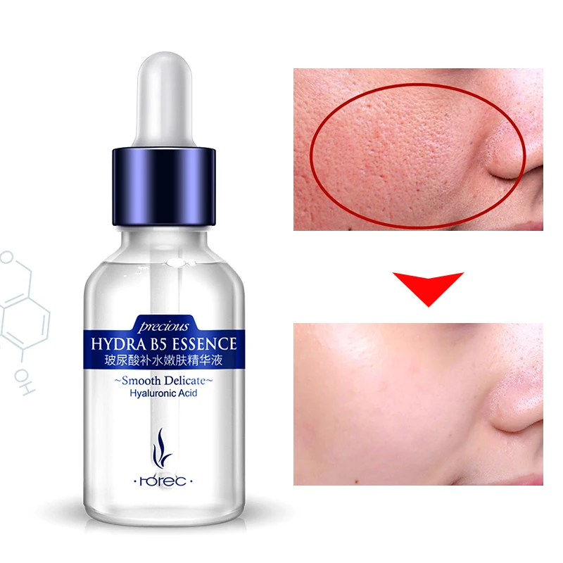 ROREC эссенция гиалуроновой кислоты для ухода за кожей сыворотка лица жидкость