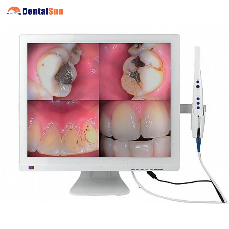 

M-998(2-in-1) Intraoral Camera+Self-contained 19inch LED Monitor