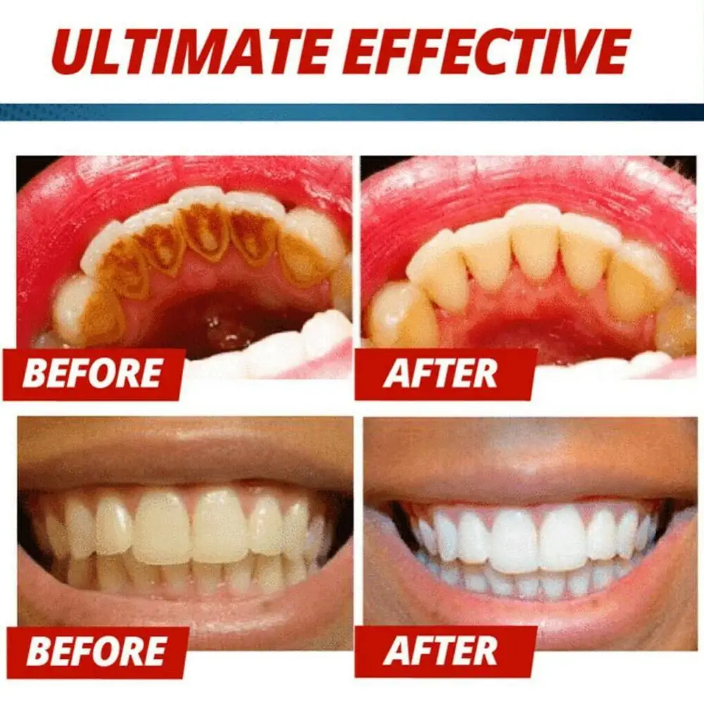 

Oral Hygiene