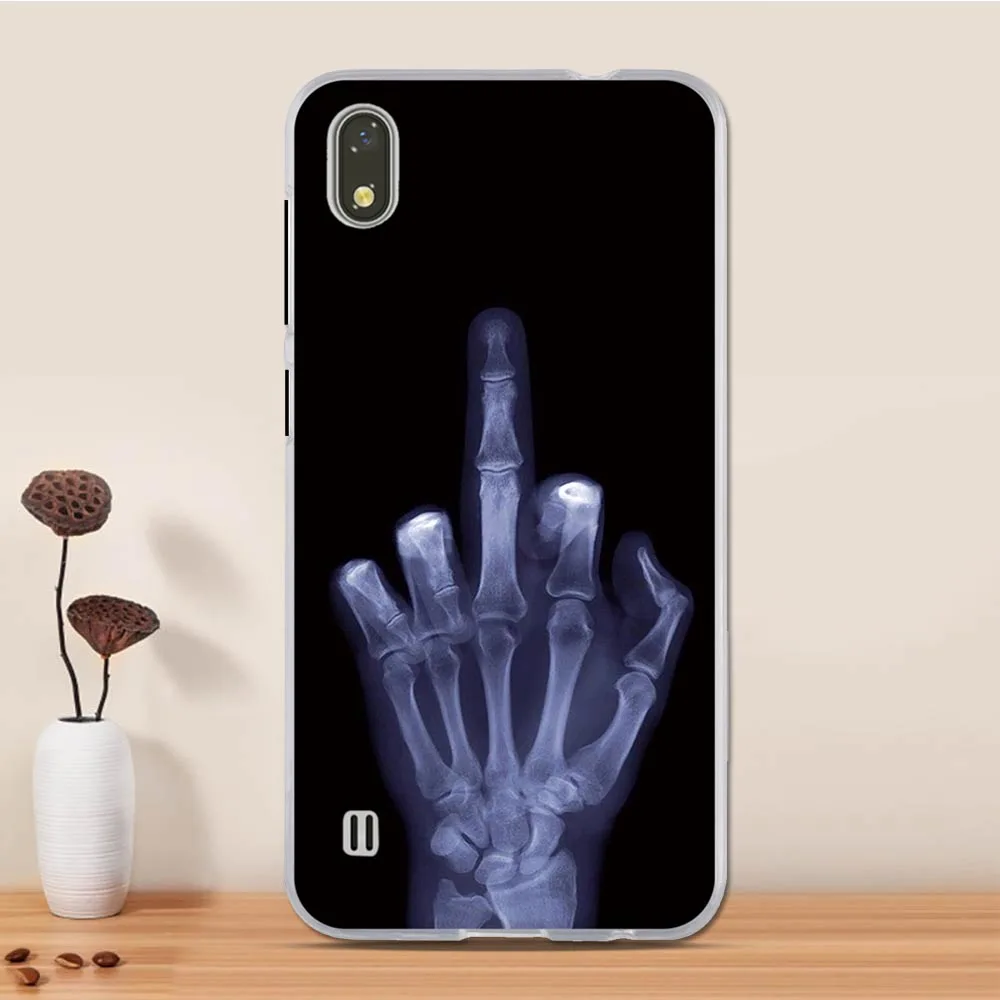 19 Для zte Blade A530 Чехол Мягкий ТПУ чехол для телефона zte A530 чехол Бампер корпус задняя крышка для zte Blade A530 силиконовый чехол - Цвет: 19