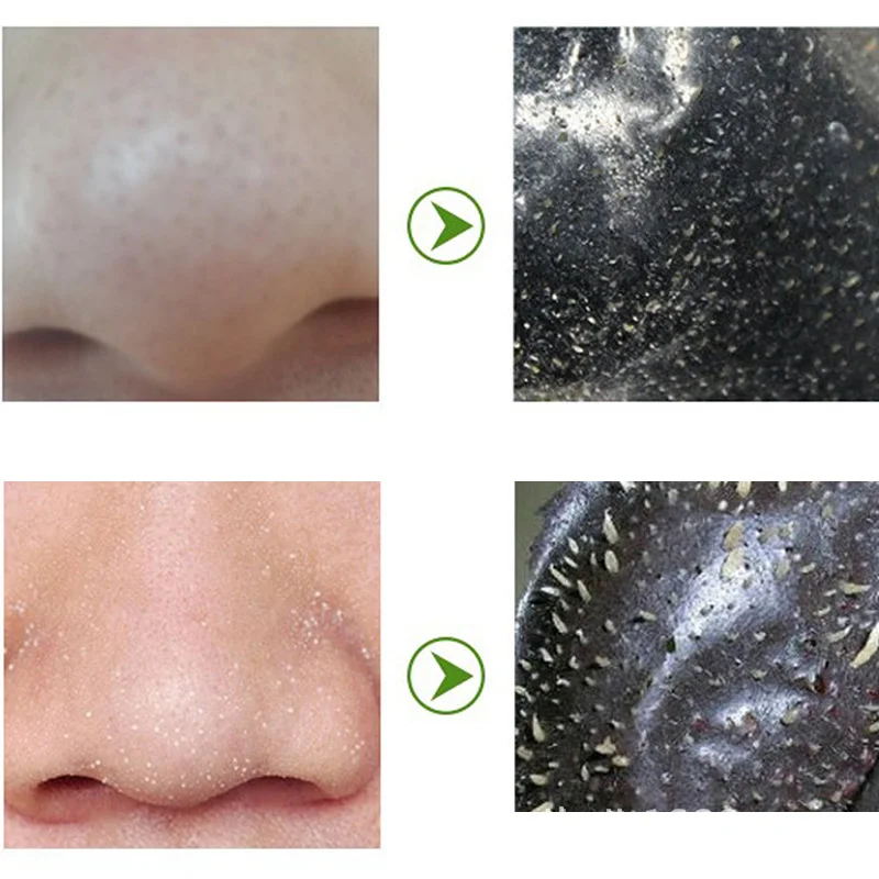 

2019 Hot 10Pcs Unisex Nose Strips Deep Cleanse Pore Cleansing Blackheads Pack Removal Hot Mdf