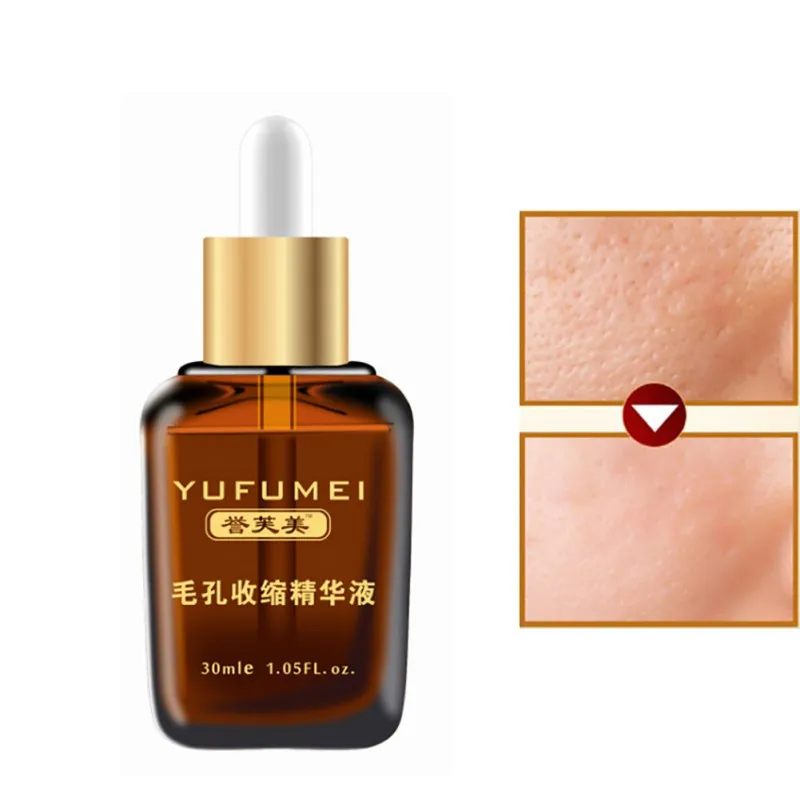 Жидкость для лечения акне 30 мл|Сыворотка| |