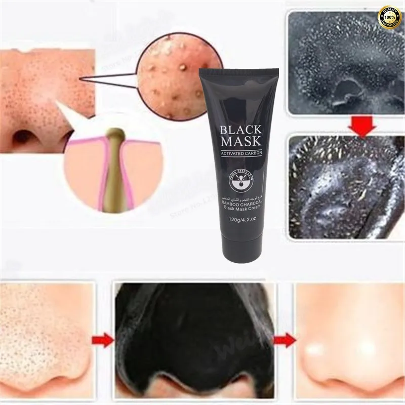 Оптовая продажа черная маска для лица удаление угрей лечение акне головы Mascarilla