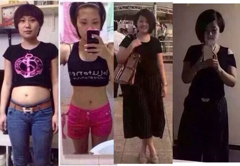 Пластыри для похудения пластыри сжигания жира продукты 40 шт.|patch minceur|weight loss patchslim