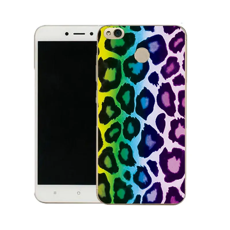 QMSWEI Clear Phone Case For Mi 6 5 5s note3 Redmi note4x 4x 3s 5a 4a note5a Painted TPU Soft Eyeshadow Canvas Dog Cover |