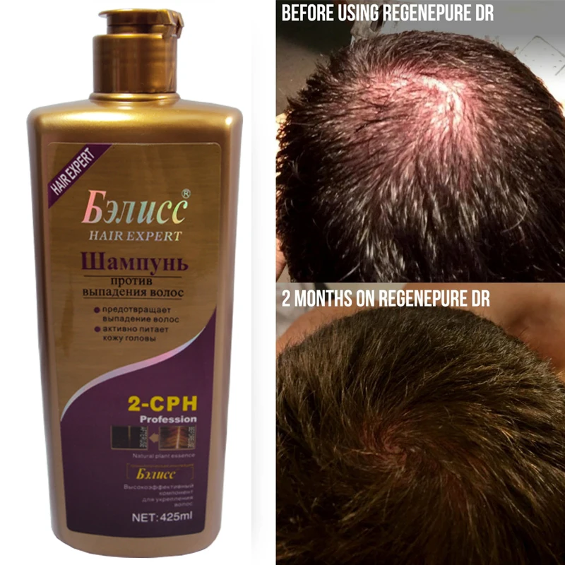 

Anti-off Hair Growth Natural Herbal Chinese Anti Dandruff Shampoo 420g Free Shipping
