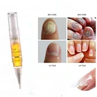 5 мл жидкая ручка для лечения Ногтей противогрибковая инфекция ногтей увлажняющее масло для ногтей Восстанавливающее Средство для удаления кутикулы Уход за ногтями TSLM1