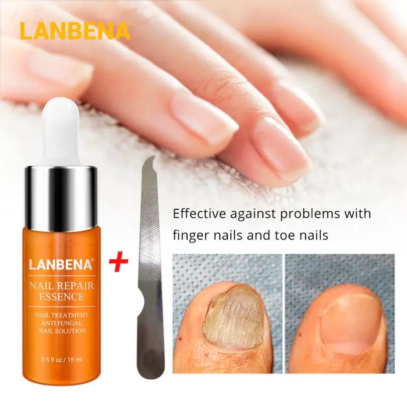 Эссенция для лечения Ногтей отбеливание ногтей и ног удаление грибка 8 9 | Красота