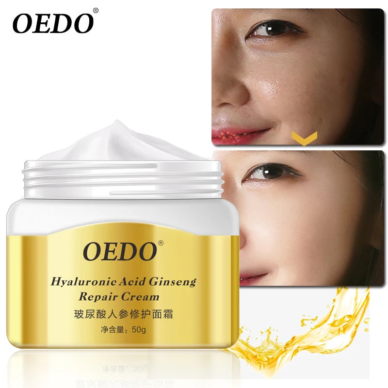 Гиалуроновая кислота экстракт женьшеня ремонт крем для лица с несколькими