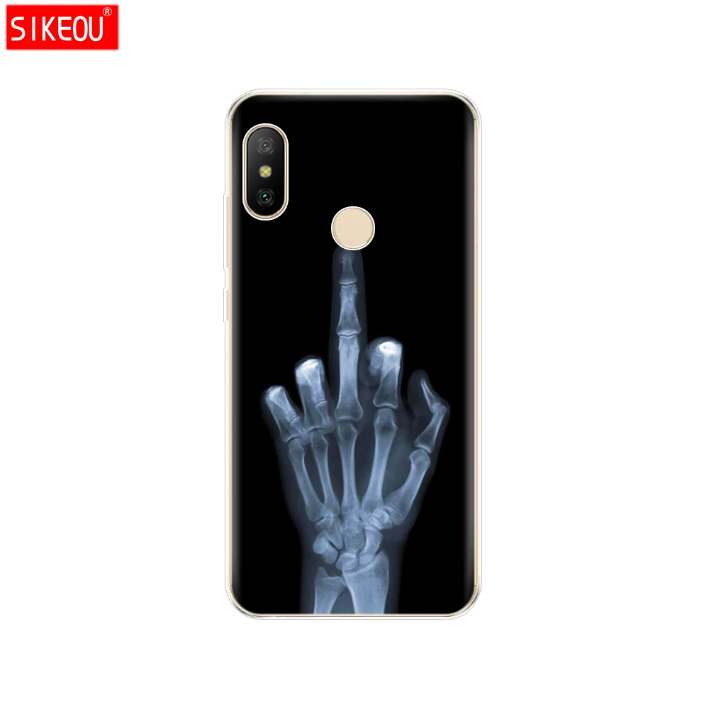 12052 Силиконовый чехол для Xiaomi mi A2 LITE, чехол с полной защитой, мягкая задняя крышка из ТПУ, чехол для телефона s для Xio mi A2 LITE, бампер, чехол с котом - Цвет: 12052