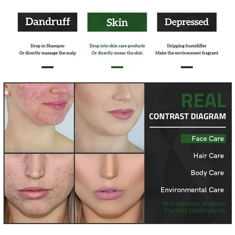 Масло чайного дерева 30 мл увлажняющее антиакне противовоспалительное