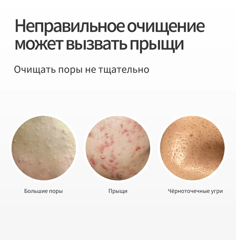 HANAJIRUSHI очищающее средство для лечения акне удаляет акне лицо умывальник для лица очищающее средство для лица контроль масла против акне от прыщей 60 г