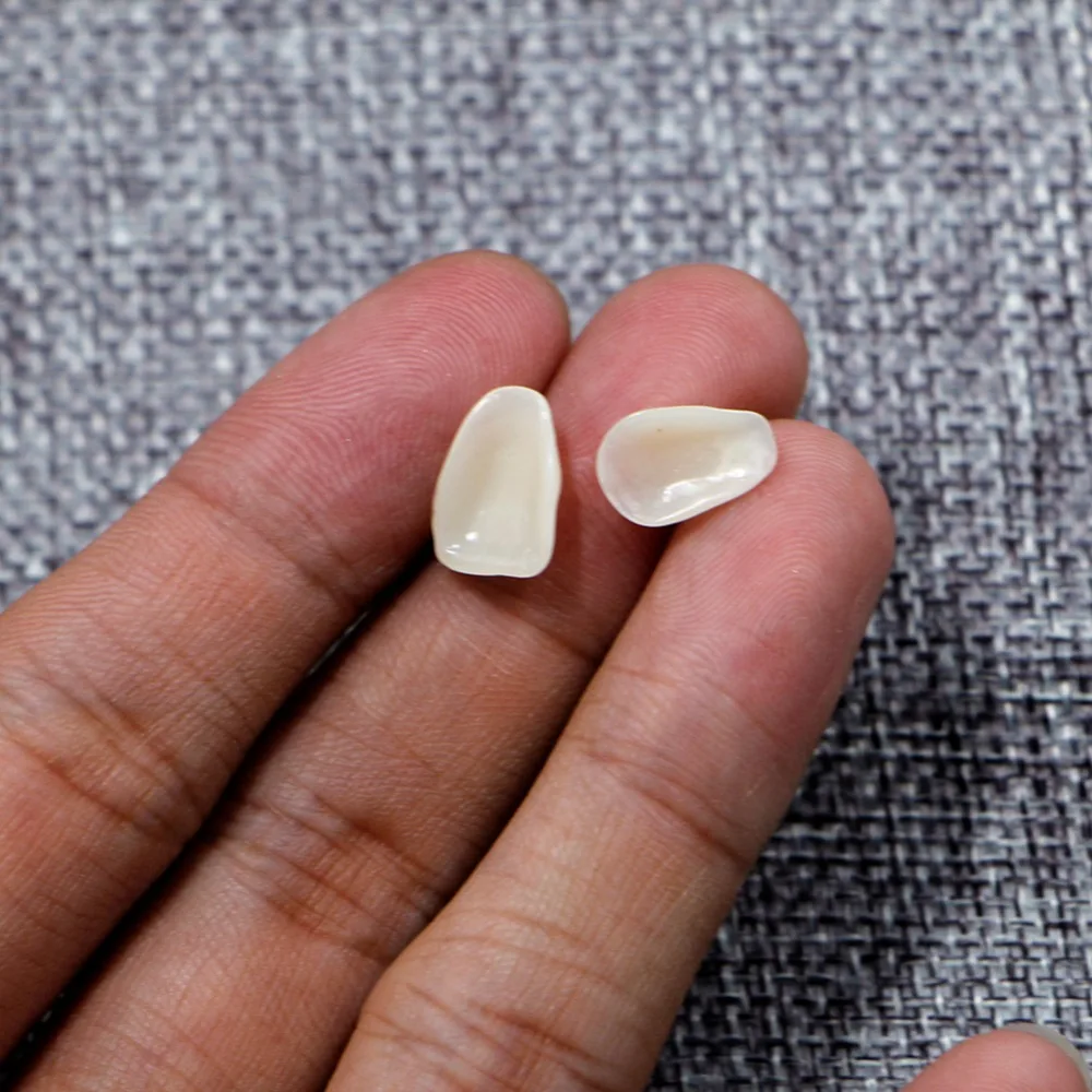 Ультратонкие стоматологические отбеливающие виниры 1 мешок смола для передних