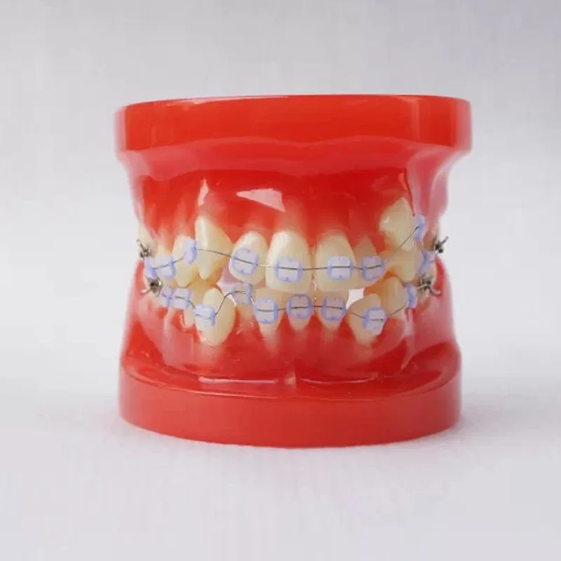 28pcs Teeth all ceramic bracket Orthodontics Dental Tooth Model | Канцтовары для офиса и дома