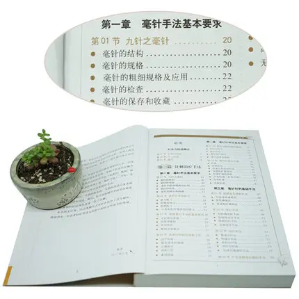 Графическая иглоукалывание и прижигание Daquan китайские книги по медицине zhong yi zhen