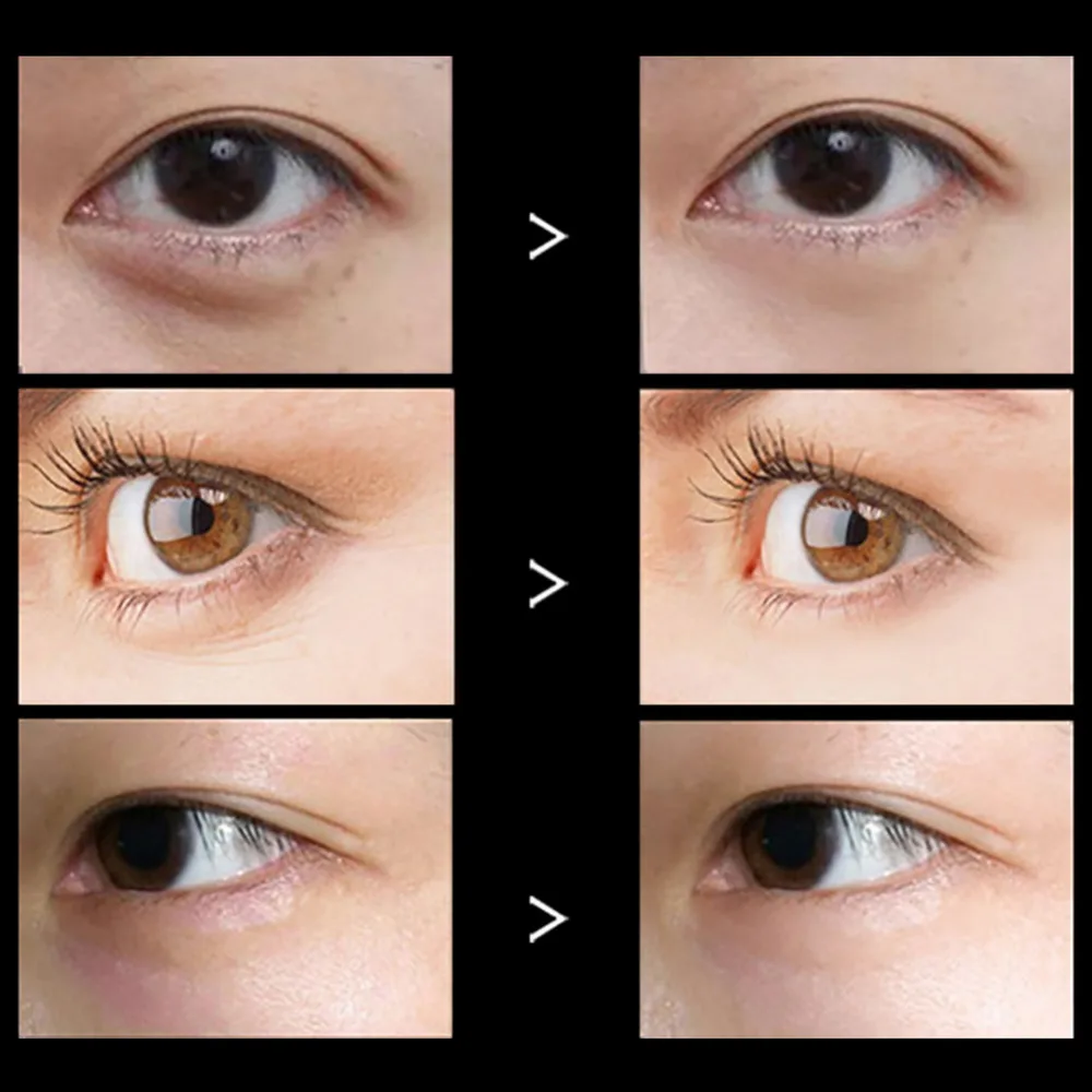 Маска для глаз с черным жемчугом и коллажем 60 шт.|Средства ухода маски| |