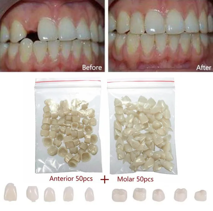 2 упаковки стоматологических материалов смешанные временные короны молярные